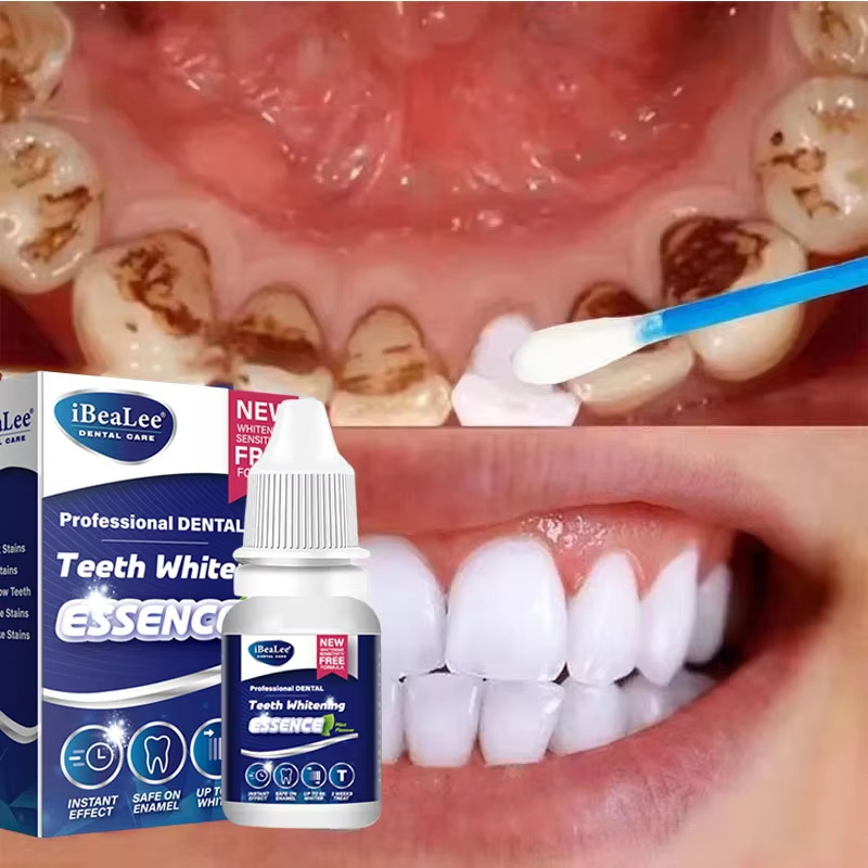 Teeth Whitening Serum - 치아 미백 에센스 플라크 얼룩 제거