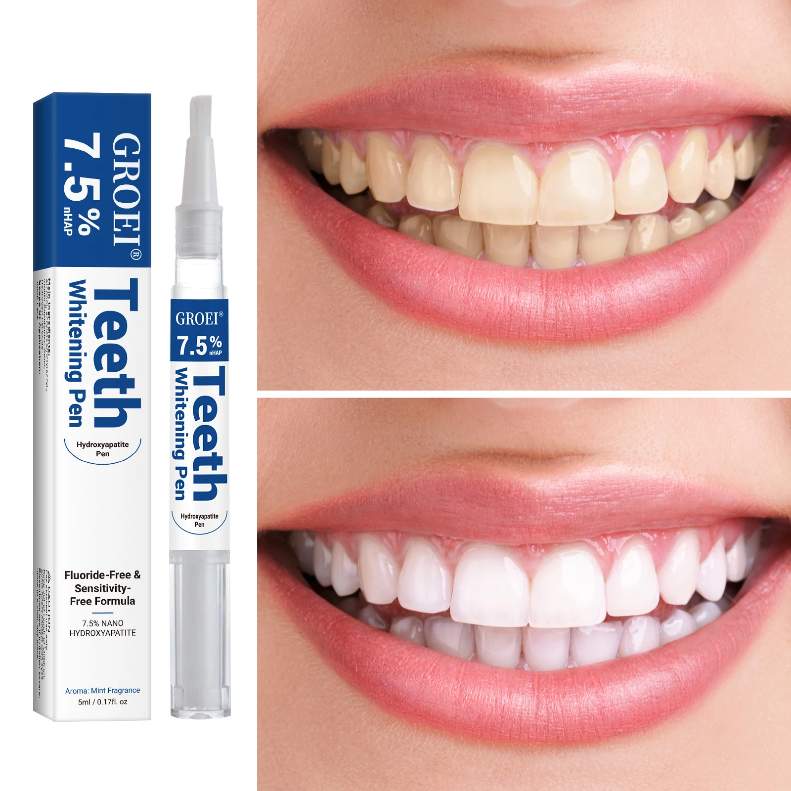 하이드록시아파타이트 치아 미백 펜 눈부신 화이트 얼룩  - Teeth Whitening Near Me 리뷰 및 가격