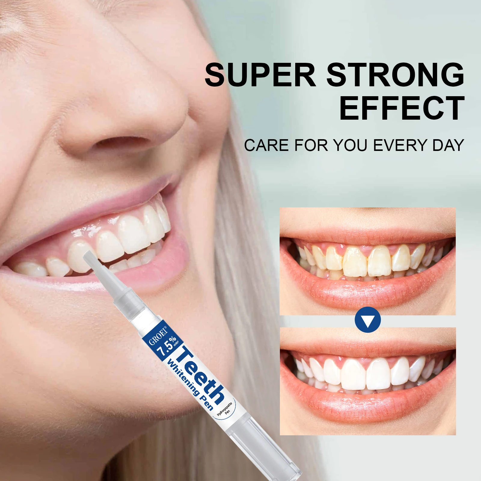 하이드록시아파타이트 치아 미백 펜 눈부신 화이트 얼룩  - Teeth Whitening Near Me 리뷰 및 가격