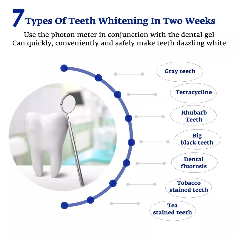 지능형 LED 블루 라이트 휴대용 USB/iPhone/ - Teeth Whitening Blue Light 리뷰 및 가격