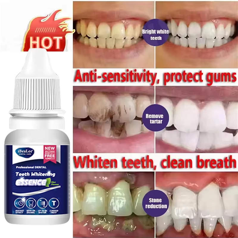 치아 미백 에센스 플라크 얼룩 제거 세럼 신선한 호흡  - Teeth Whitening Serum 리뷰 및 가격
