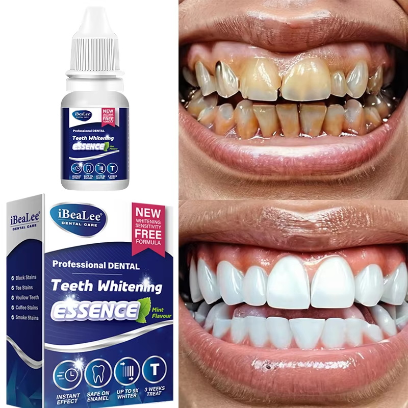치아 미백 에센스 플라크 얼룩 제거 세럼 신선한 호흡  - Teeth Whitening Serum 리뷰 및 가격
