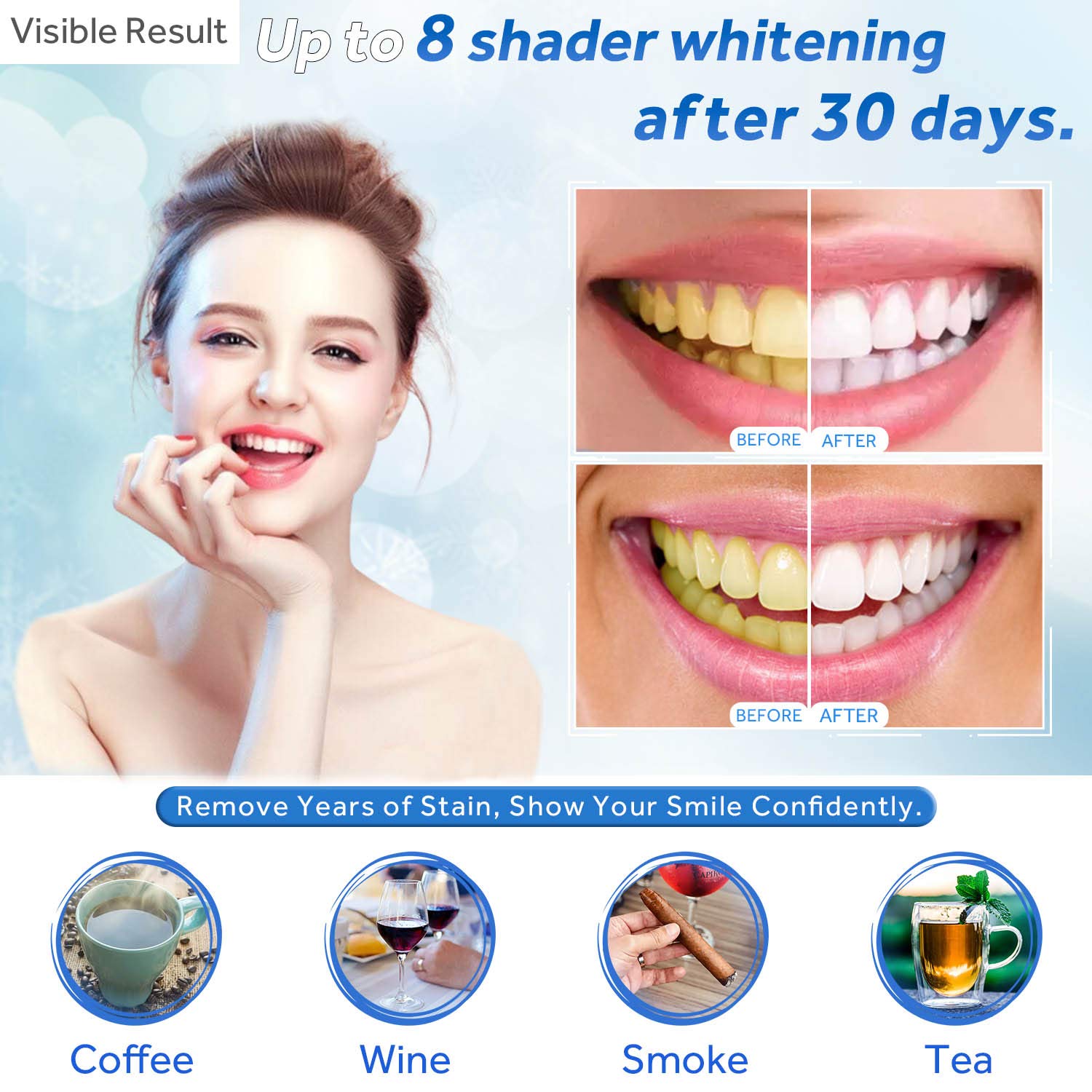치아 미백 젤 리필 주사기 치아 미백 젤 인비스알라인  - Teeth Whitening Near Me 리뷰 및 가격