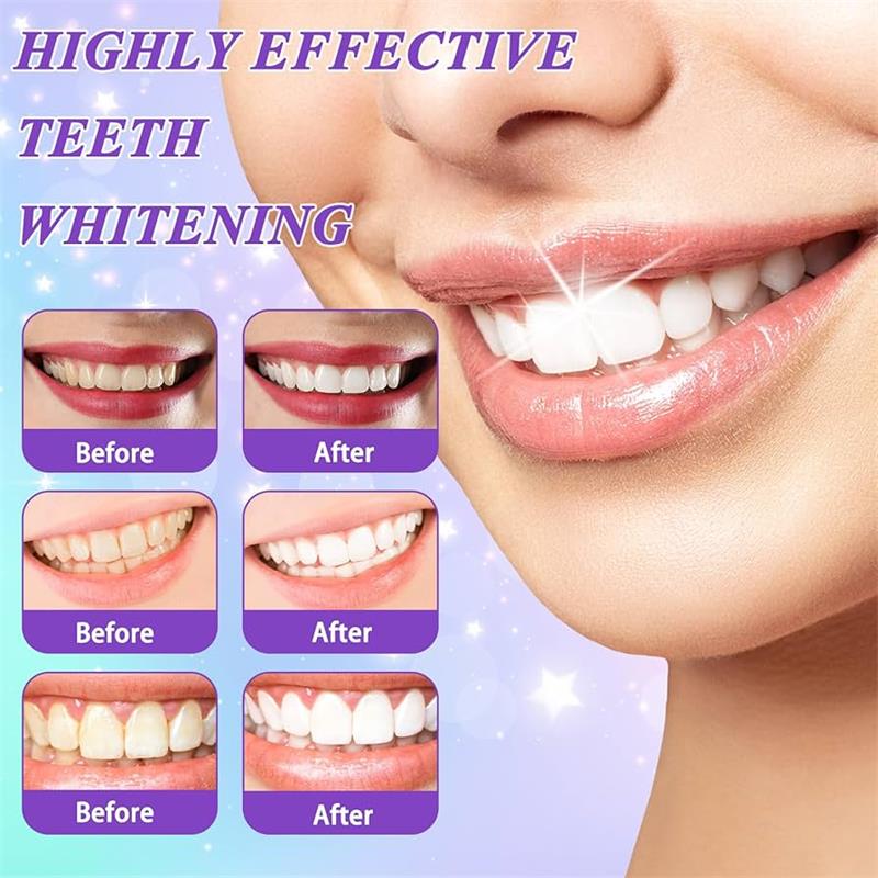 9D 퍼플 치아 미백 치약 무스, 누런 치아 및 플라그 - Teeth Whitening Foam 리뷰 및 가격