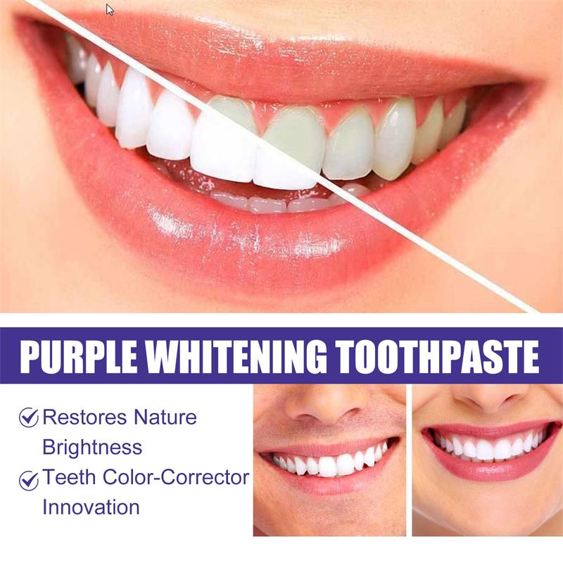 9D 퍼플 치아 미백 치약 무스, 누런 치아 및 플라그 - Teeth Whitening Foam 리뷰 및 가격
