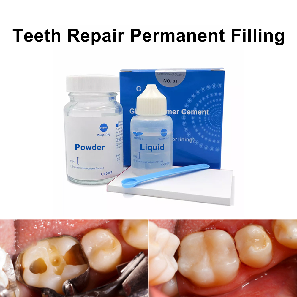 구강 구멍 필러 치아 충치 복원 재료 치과 치료 세트  - Teeth Whitening At Home Kit 리뷰 및 가격