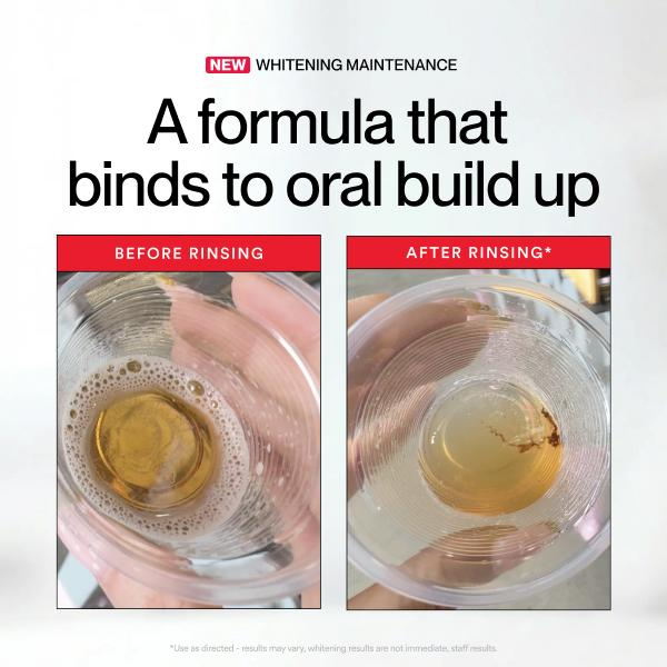 히스마일 ID 화이트닝 스테인 마우스워시 237ml 오 - Teeth Whitening Products 리뷰 및 가격