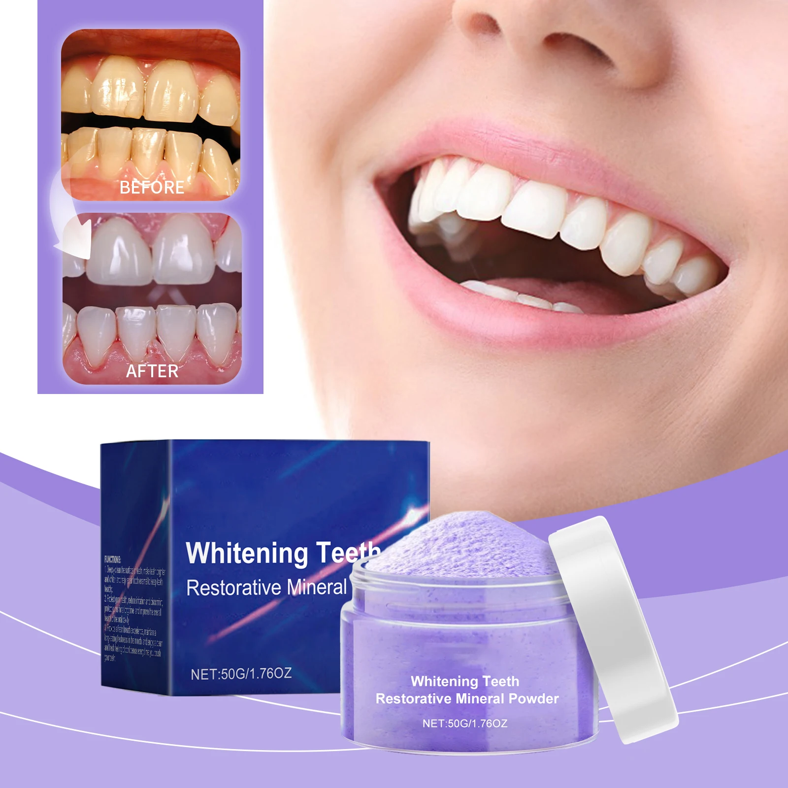 새롭게 업그레이드된 치아 미백제, 치아 미백 키트, 치 - Teeth Whitening Serum 리뷰 및 가격