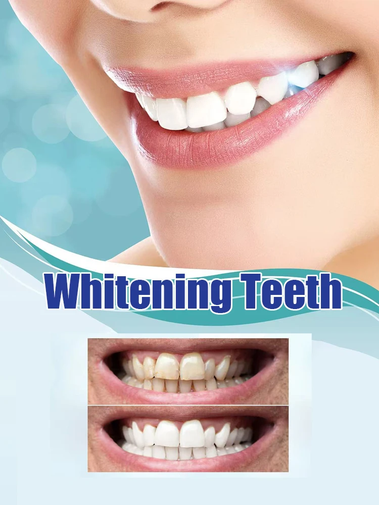 새롭게 업그레이드된 치아 미백제, 치아 미백 키트, 치 - Teeth Whitening Serum 리뷰 및 가격