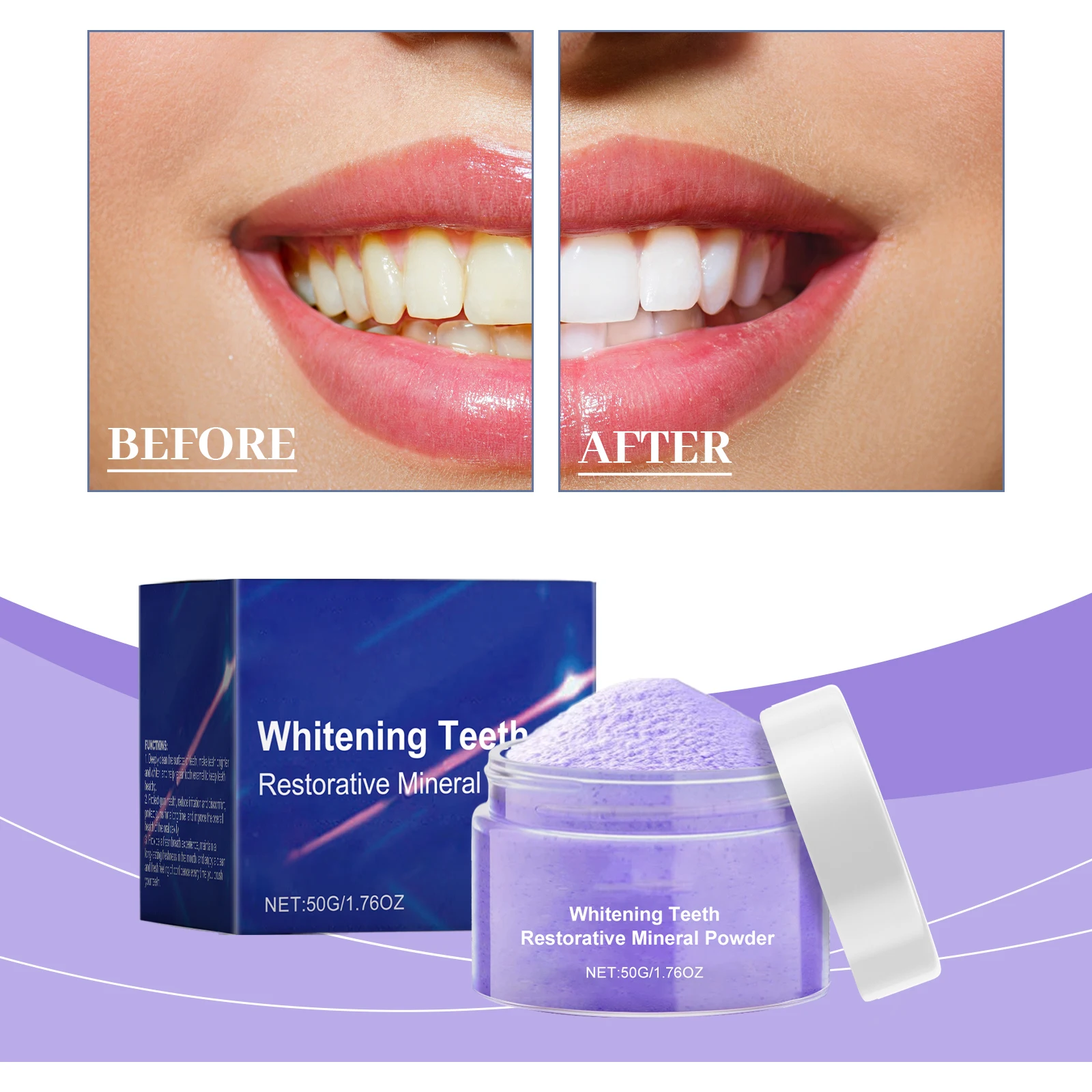 새롭게 업그레이드된 치아 미백제, 치아 미백 키트, 치 - Teeth Whitening Serum 리뷰 및 가격