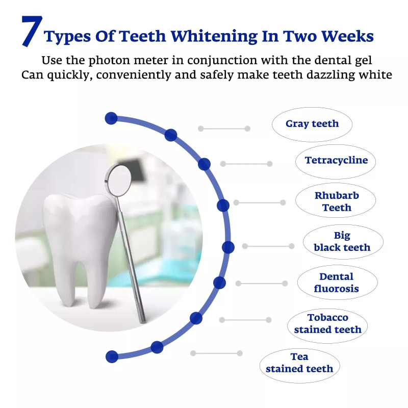 치아 미백 가속기 스마트 LED 블루 라이트 휴대용 U - Teeth Whitening Blue Light 리뷰 및 가격